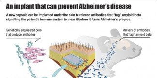Alzheimer da implantı tedavi araştırmaları