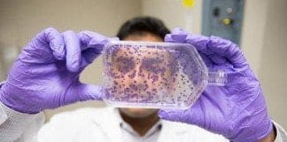 İmmunoterapi kemoterapiye alternatif mi ?