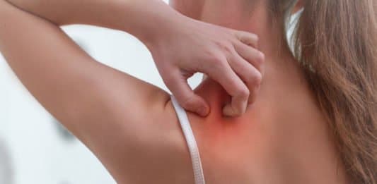 Uyuz Nedir ve Neden Olur : Dermatolog Dr. Sertaç Sever